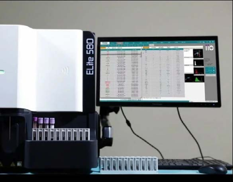 Гематологічний аналізатор ERBA Elite 580 Elite 580 фото